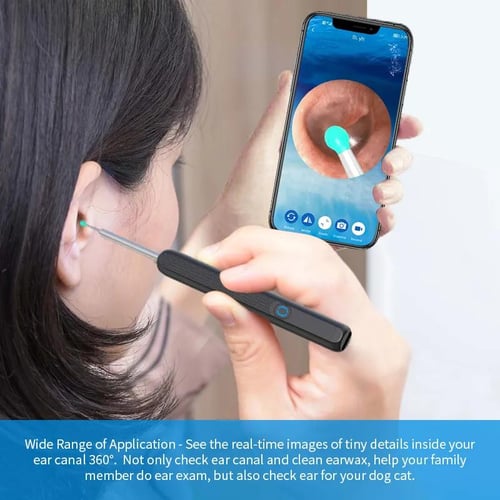 Smart scan wireless Ear Cleaner with camera